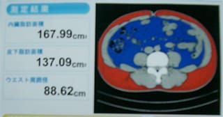 内臓脂肪測定